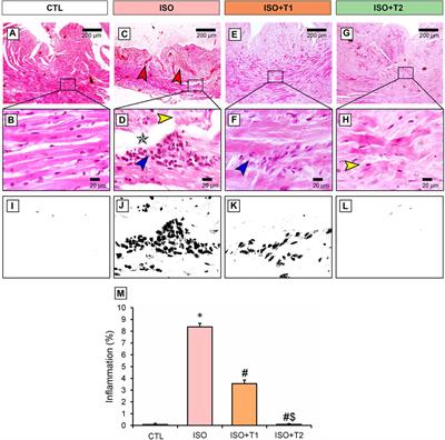 Suppression of NLRP3 inflammasome orchestrates the protective efficacy of tiron against isoprenaline-induced myocardial injury